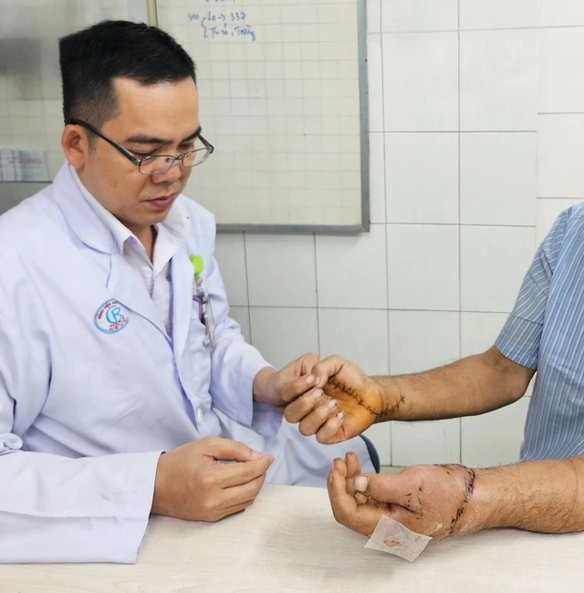 両手の接合手術を受けた患者