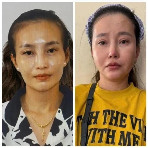 指名手配後に整形手術を受け逃亡を続けていた詐欺師の女