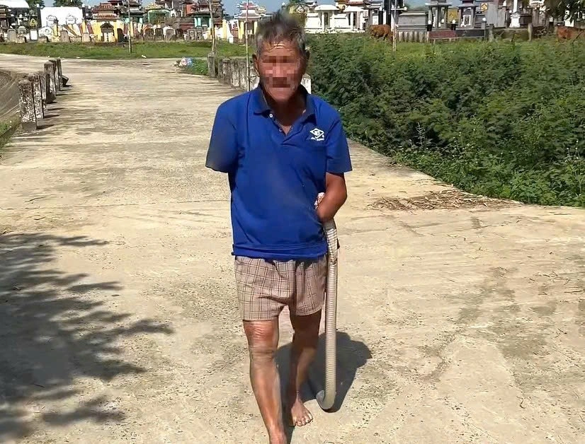 噛みつかれたコブラをわきに挟んで帰宅する79歳の男性